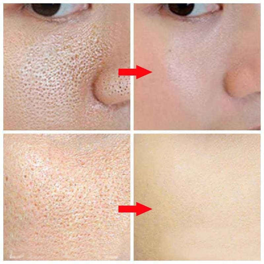 What is a Pore Refining Serum?