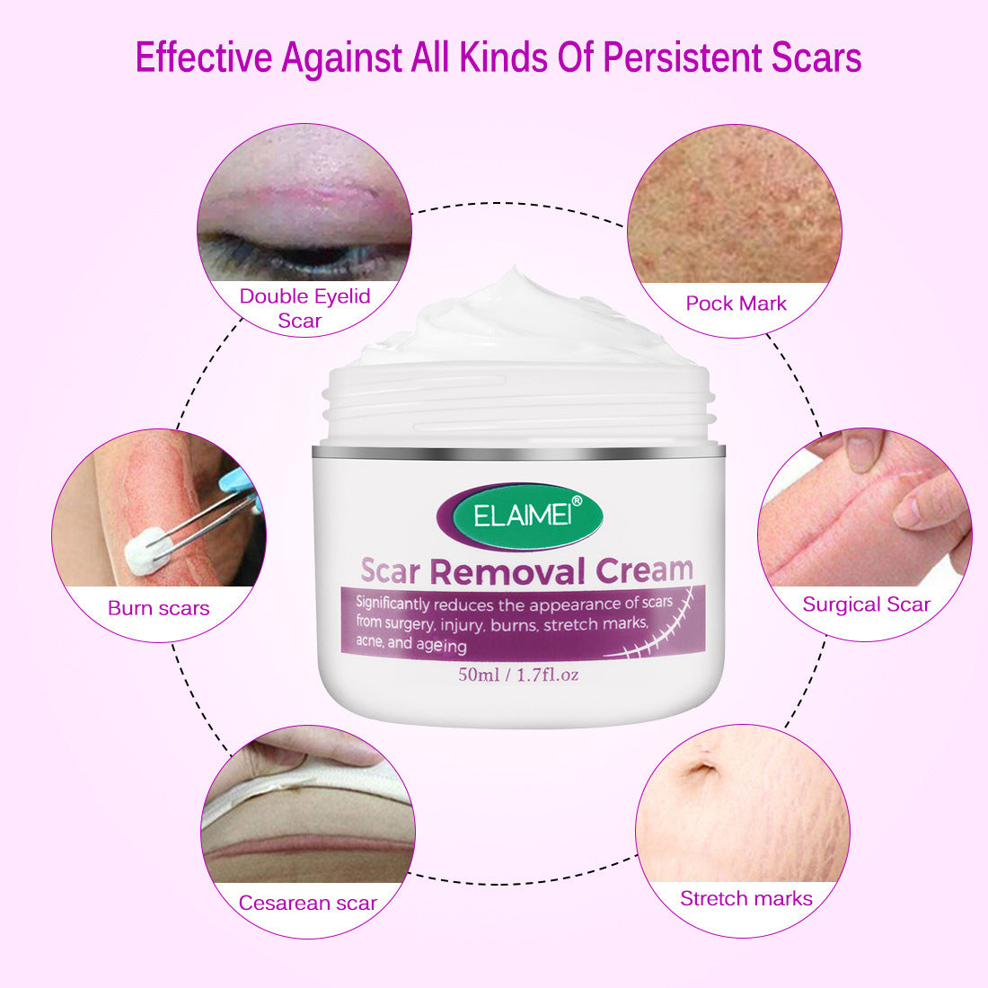 Scarless Cream Scar Removal Cream Face Acne Scar Stretch Marks Skin Repair Face Cream