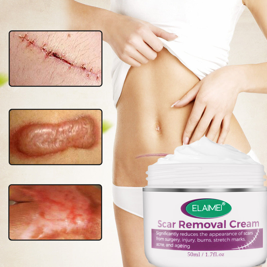 Scarless Cream Scar Removal Cream Face Acne Scar Stretch Marks Skin Repair Face Cream