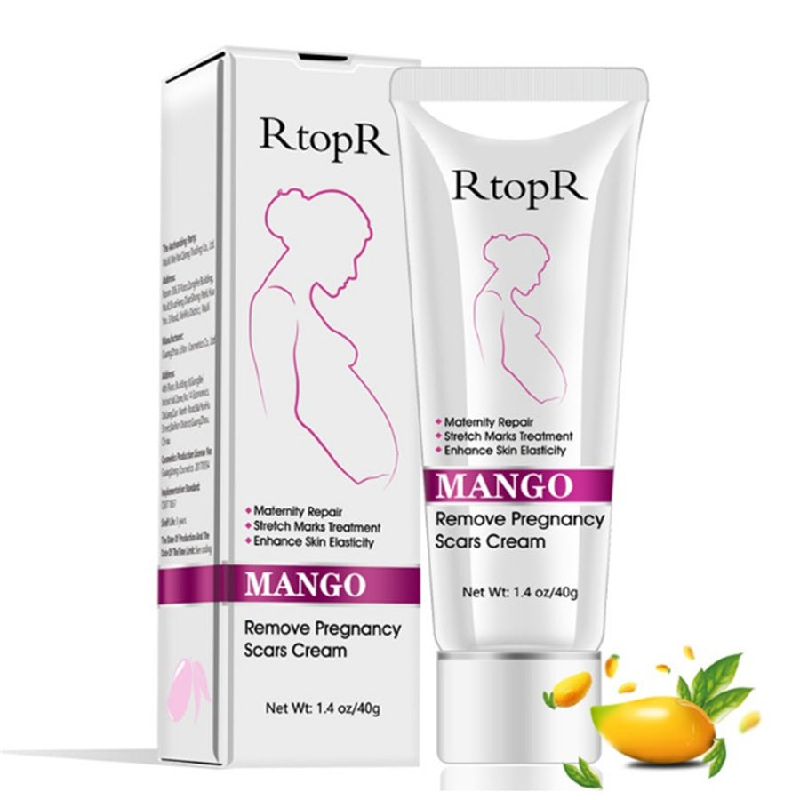 Natural Mild Non-irritating Mango Stretch Mark Cream - Rainbowsis